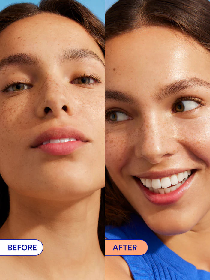 ⏳Last 3 hours! 🔥60% off - Unleash your skin's glow!