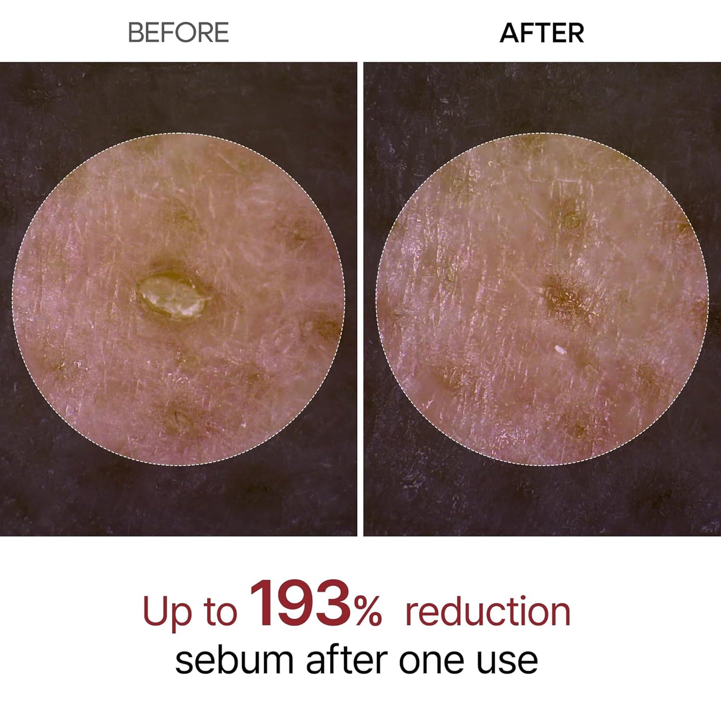 Last 3 hours: 67% off! š„TLOPAĀ® Gentle Exfoliation for Radiant Skin - Suitable for All Skin Types