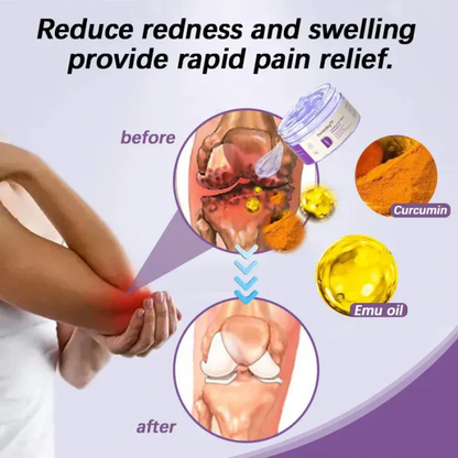 ✅Official Store: TLOPA® Turmeric and Emu Oil Arthritis Pain Relief Massage Gel👨‍⚕️