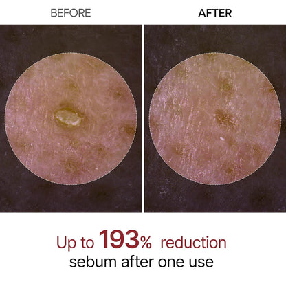 Last 1 hours: 67% off 🔥 Gentle Exfoliation for a Glowing Skin - Suitable for All Skin Types