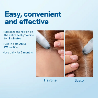 【Last Day Promotion 60% OFF🌟】Hair Growth Roll-On Serum – See hair growth in 4 weeks